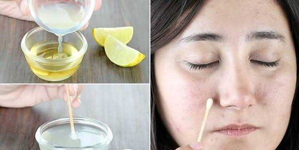 Unlock the Secrets: Lemon Juice Home Remedy for Dark Spot Removal